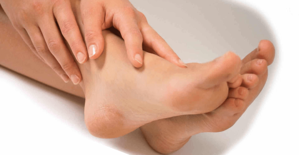 Fungal infection can affect the skin between the toes