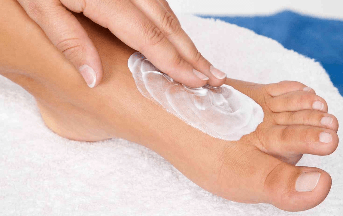 application of anti-fungal ointment on the feet