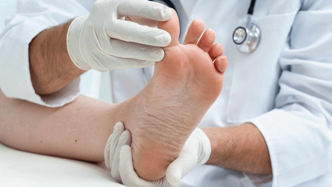 examination of the skin of the feet in an appointment with a specialist