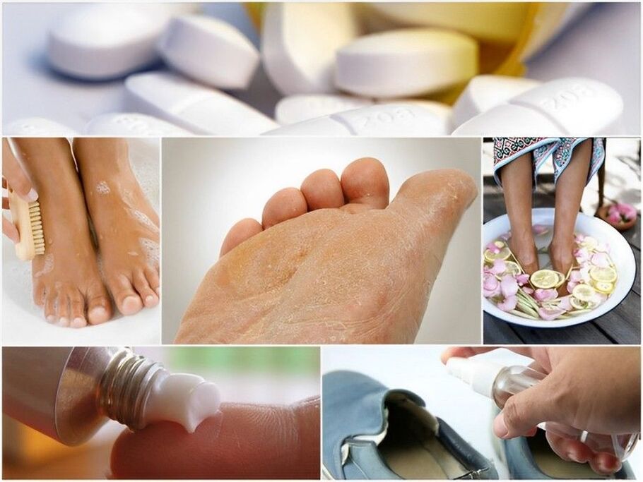 prevention of fungal nail infections