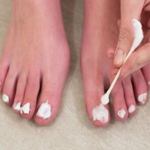 Treatment