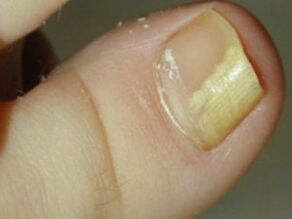 Nails