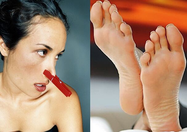 An unpleasant odor of the legs