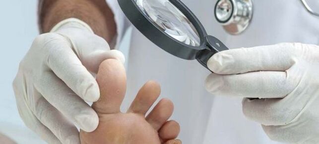 Examinations before starting mold treatment