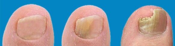 The process of mushroom development