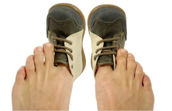 How to recognize toenail fungus by symptoms